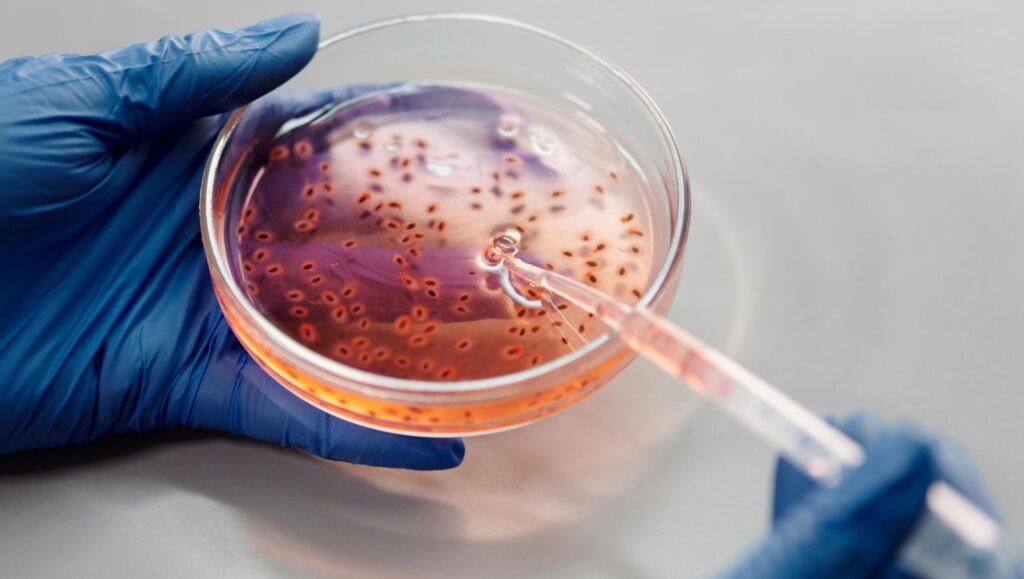 A close up view of a petri dish showing red blood cells under a laboratory microscope during an evaluation for sickle cell disease.